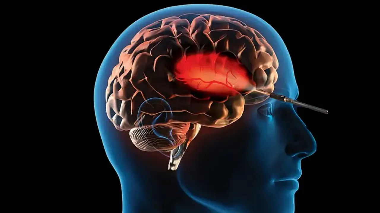 Lucknow hospital surgically treats ‘suicide disease’