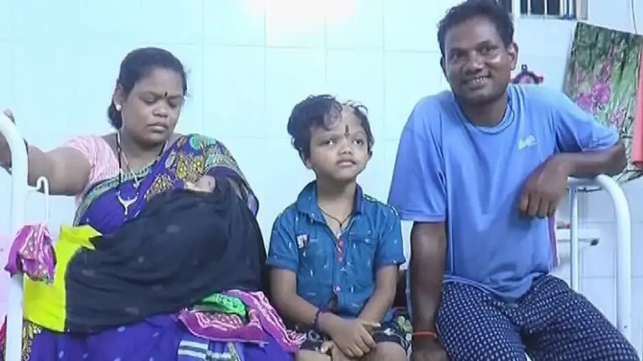 Conjoined twin survivor Jaga