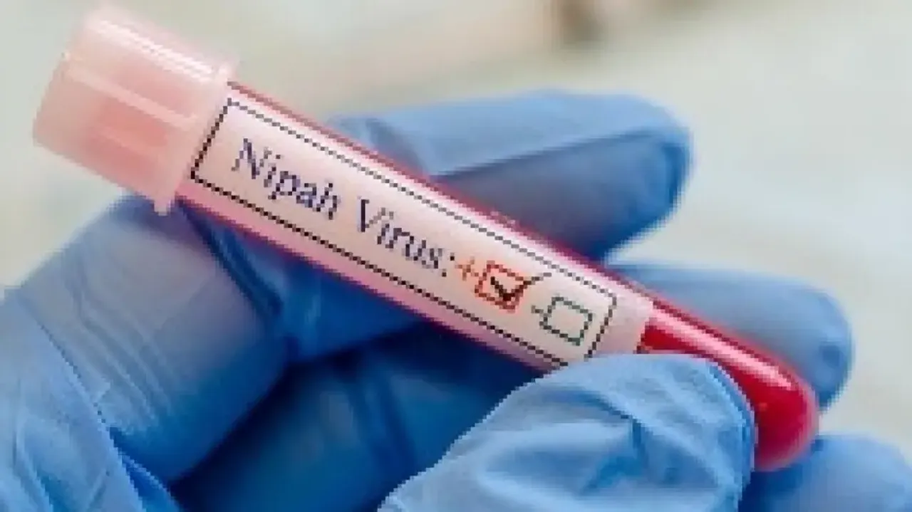 NIPAH Virus