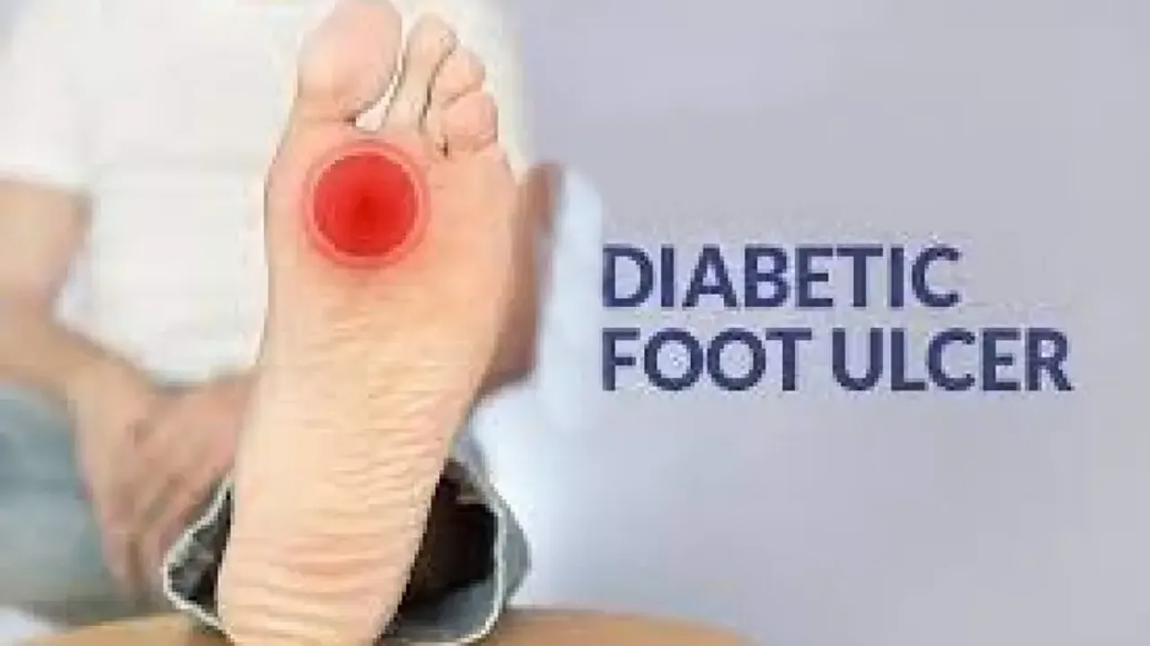 foot ulcers in diabetic patients