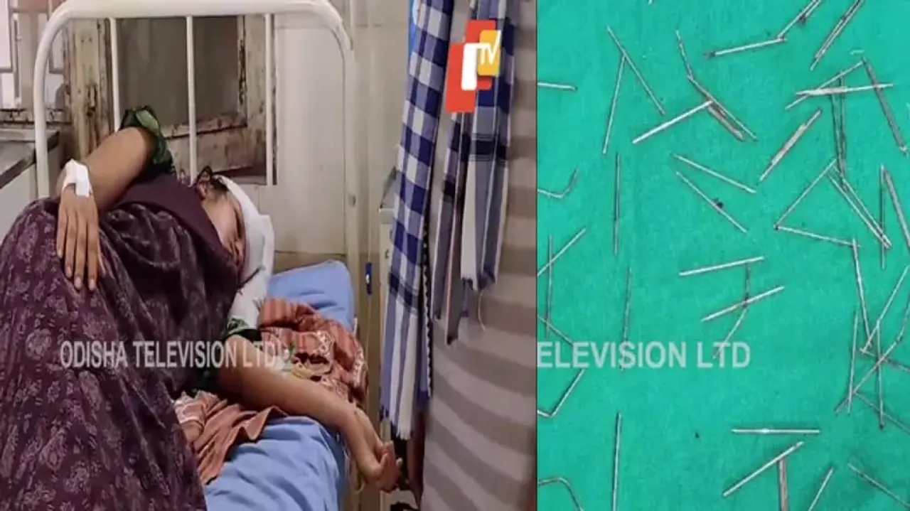 70 needles removed from girl's skull in Bolangir