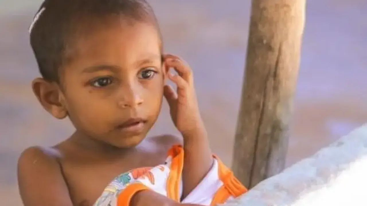 582 mn people worldwide will be chronically undernourished in 2030: UN report