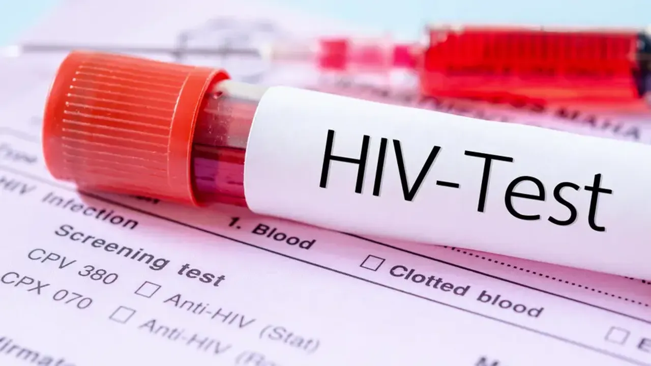 An experimental cancer drug may hold the key to clearing HIV from infected brain cells