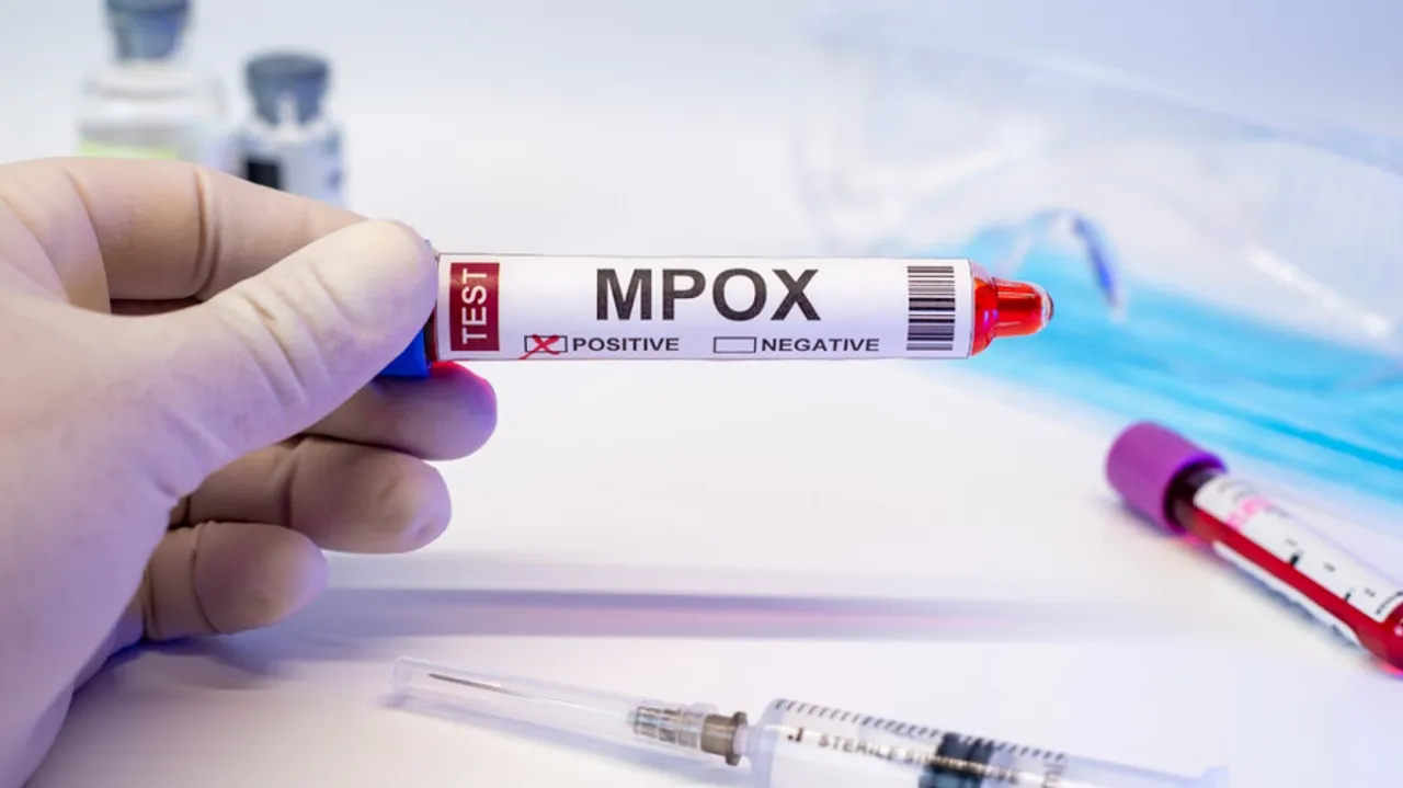 Monkeypox scare: Odisha govt begins surveillance at all entry points