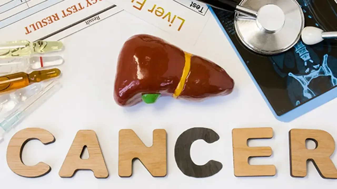 Liver cancer