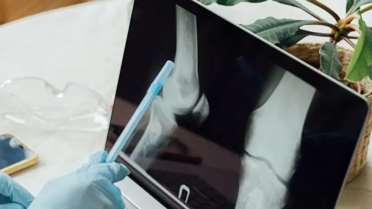 NIT Rourkela researchers develop natural bio-ink for 3D bioprinting of bone tissue