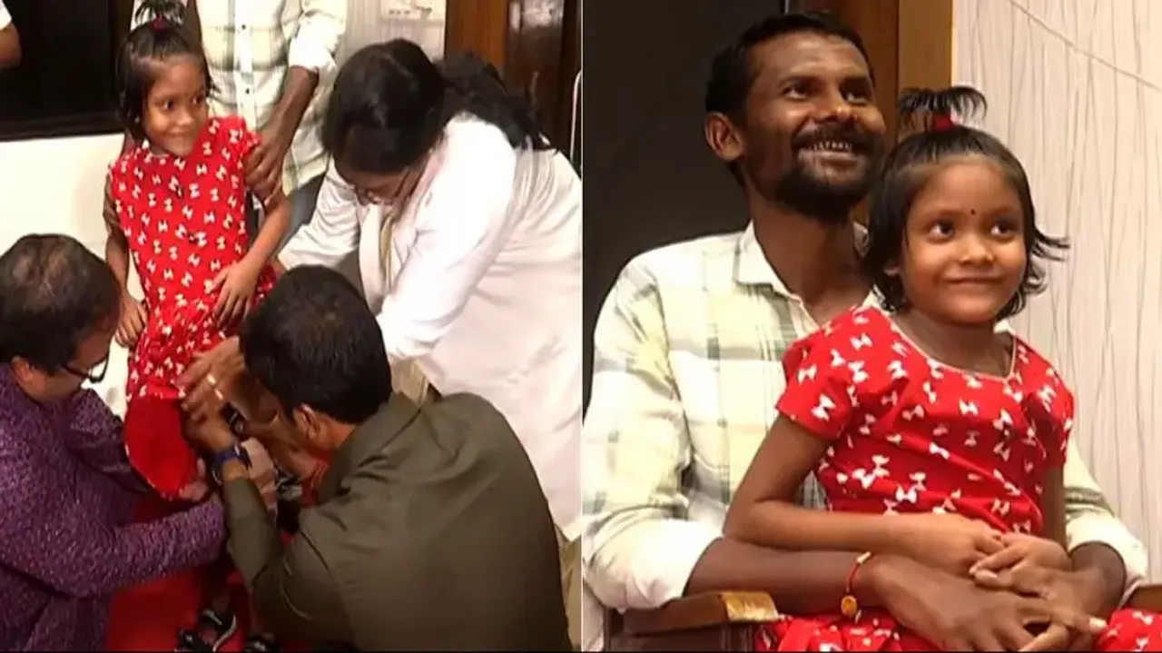 Girl receives artificial leg after losing limb in accident in Odisha