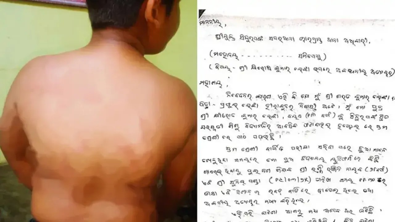 Injury marks on the victim boy (L) and FIR copy (R)