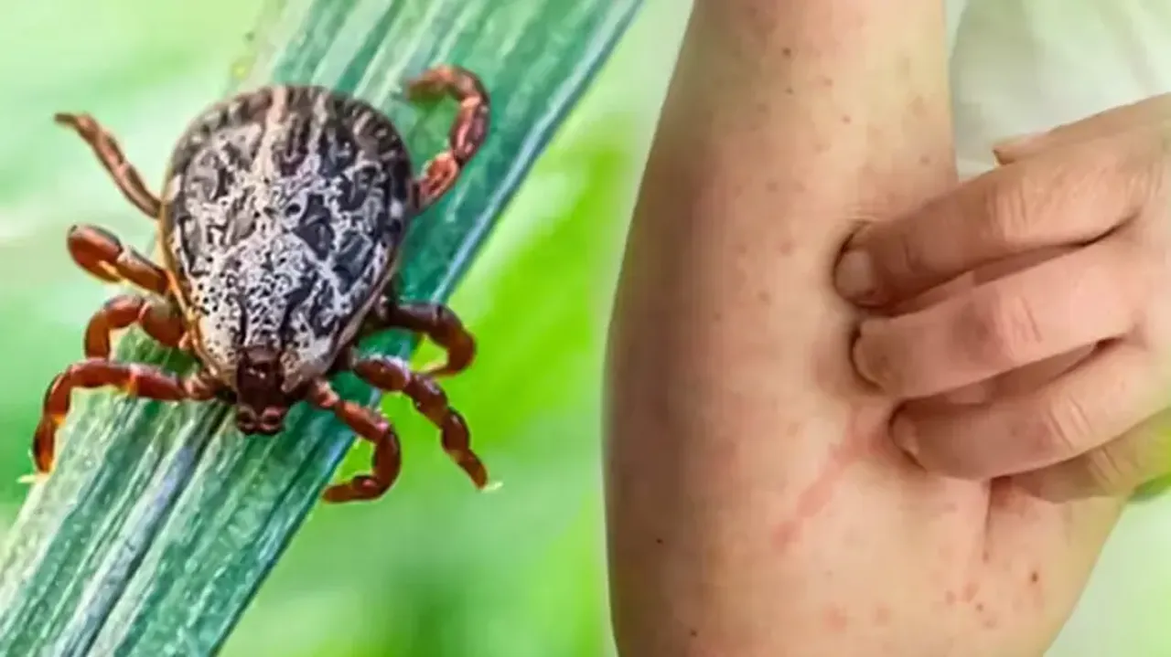 Scrub Typhus scare in Odisha's Bargarh