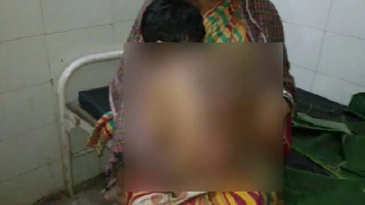 Hot rice gruel thrown at minor girl