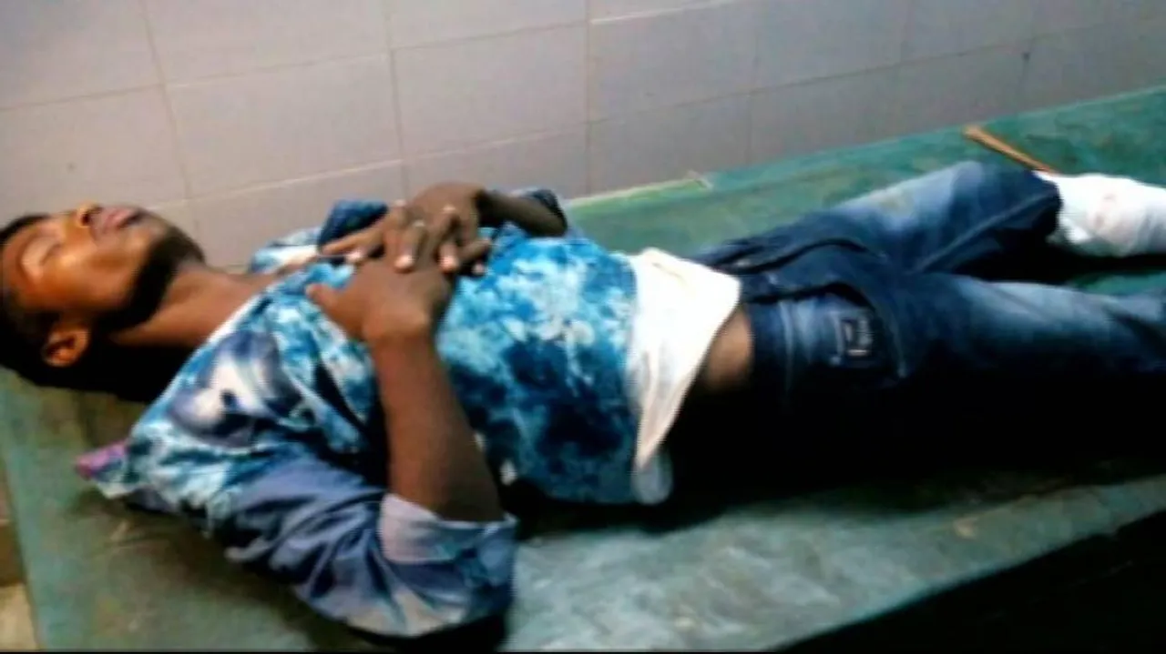 Inter-state dacoit injured in encounter