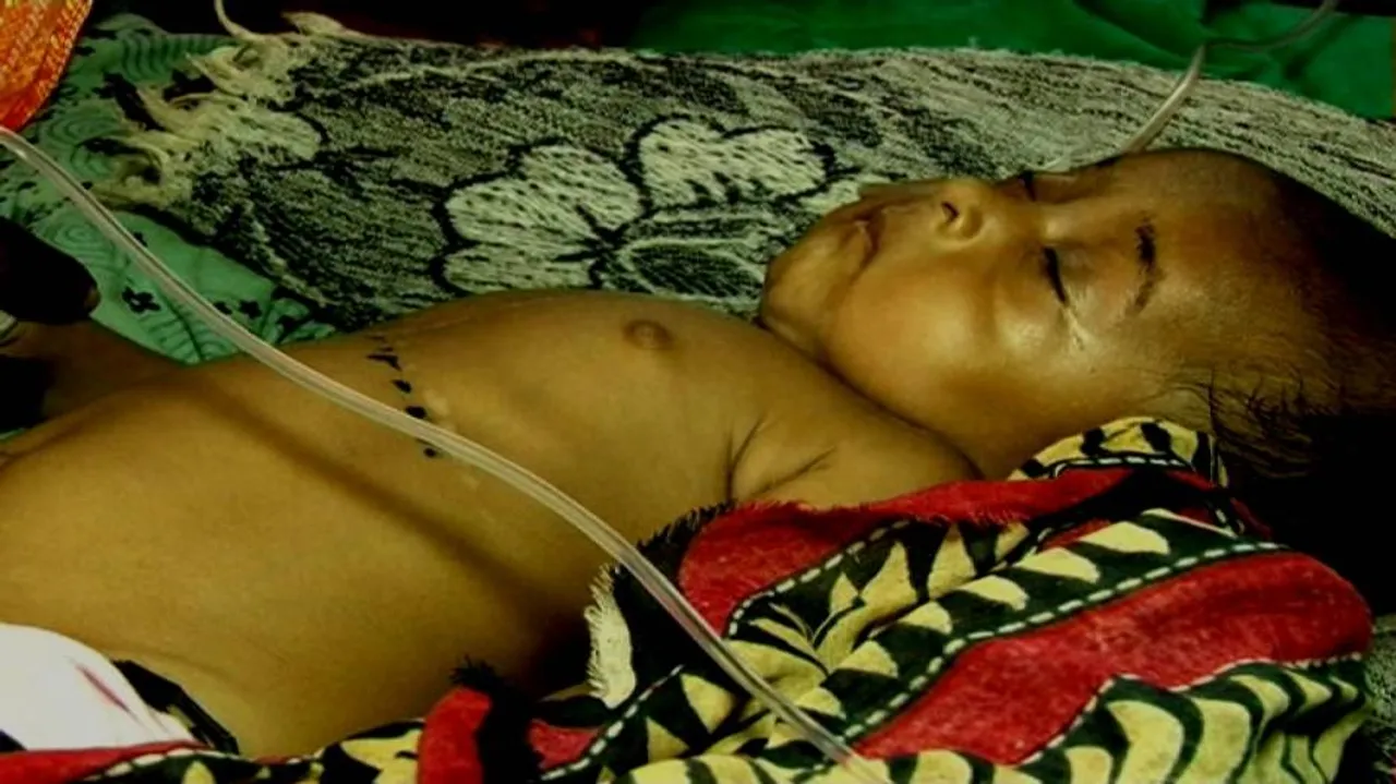 Two-month-old branded with hot iron, hospitalized