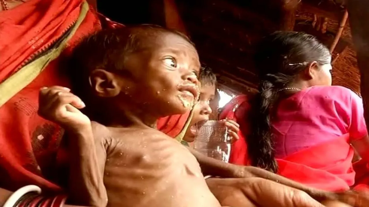 Odisha govt whitewashes malnutrition death data