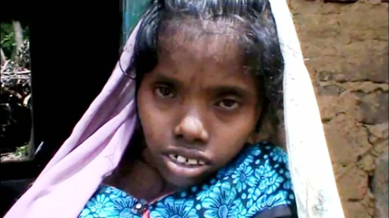 Rayagada admin to bear medical expenses of girl with rare condition