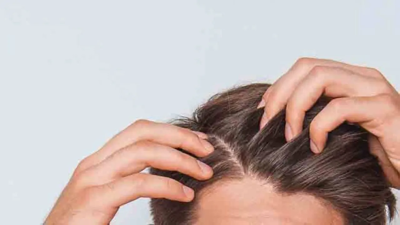 Protect your scalp from getting itchy, dry