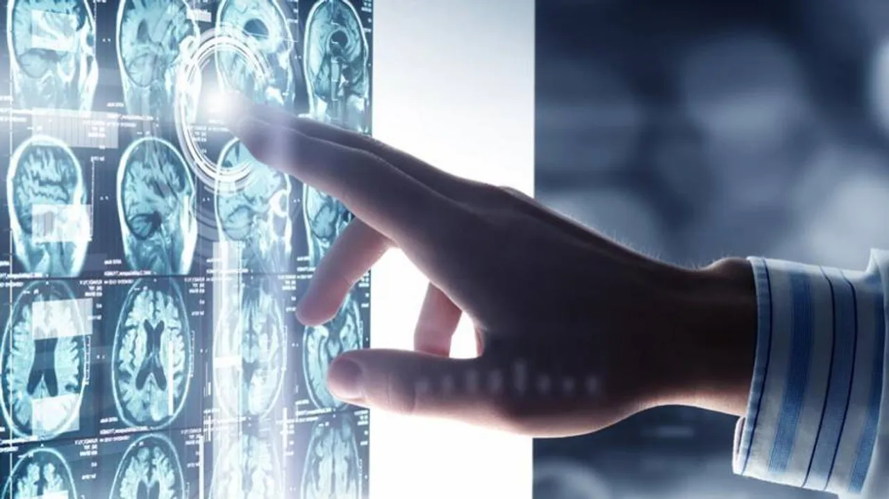 Researchers develop new scale to measure wisdom
