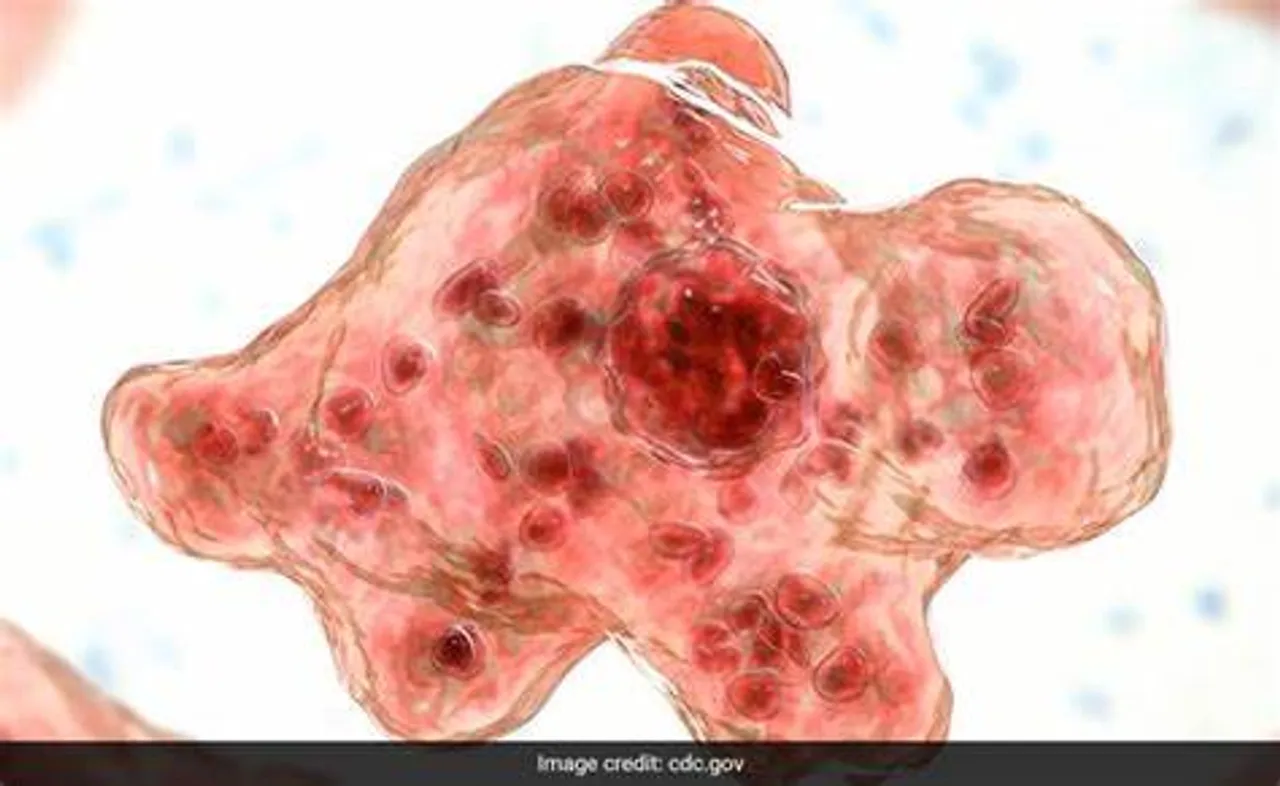  brain-eating amoeba
