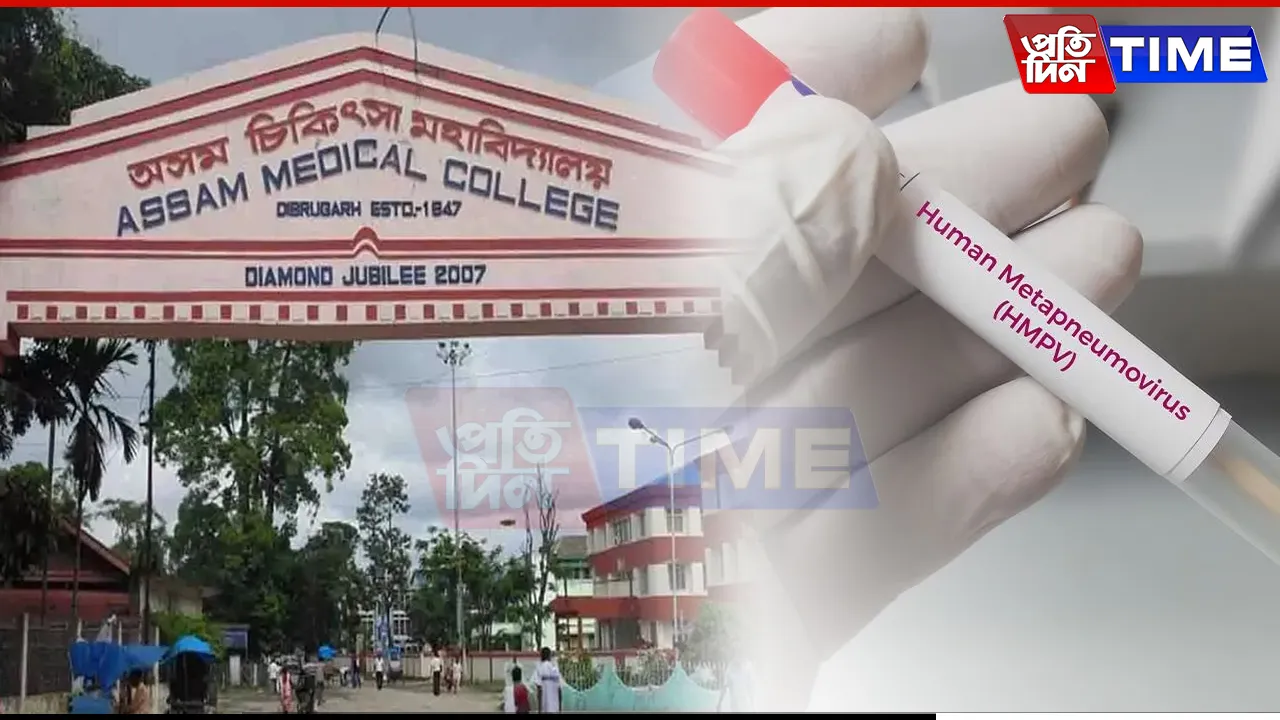 10-Month-Old Diagnosed with HMPV in Assam, Under Treatment at AMCH