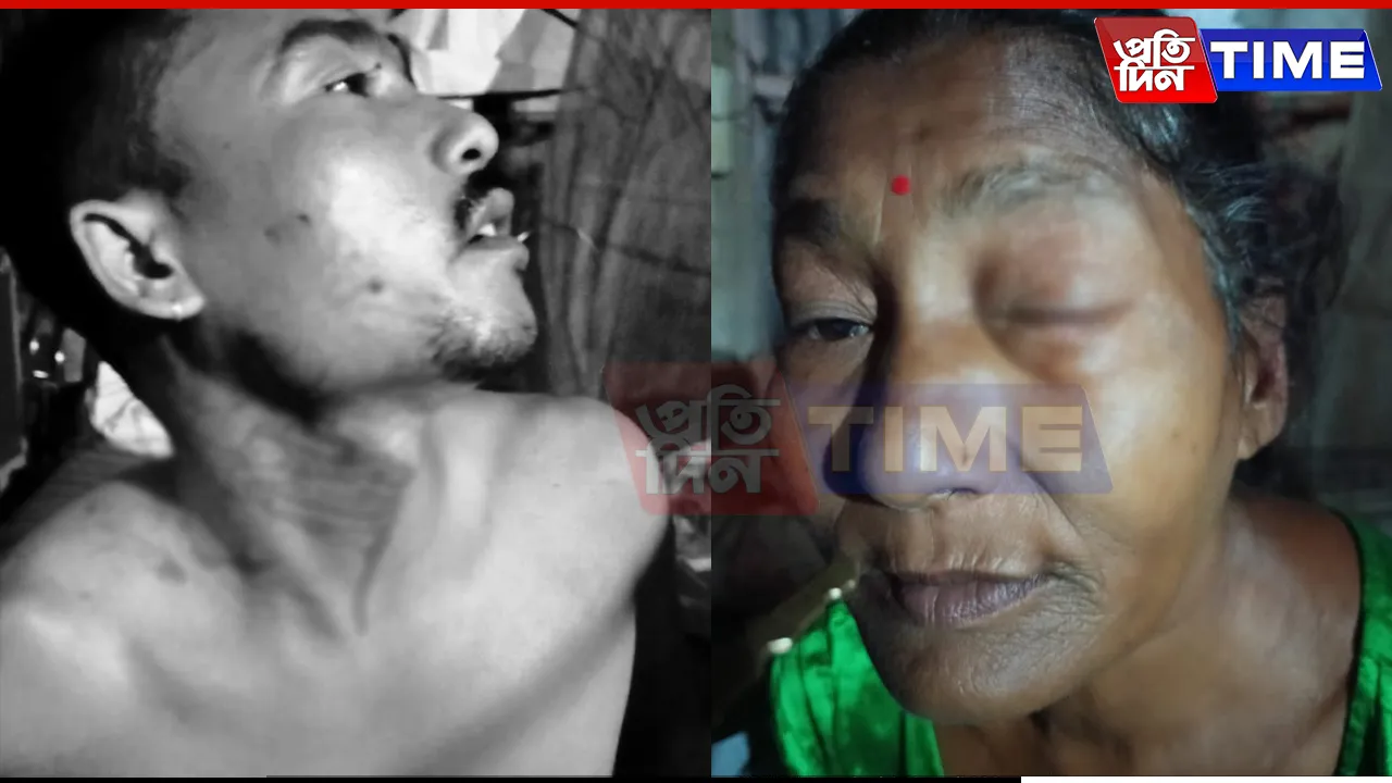 Youth Attacked with Blade Over Bihu Donation Dispute in Guwahati’s Odalbakra