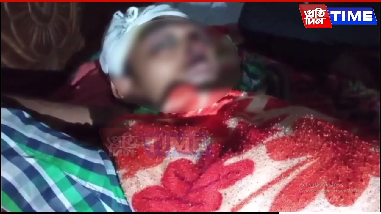 Assam: Youth Abducted and Brutally Attacked in Cachar, Found Bleeding by Roadside