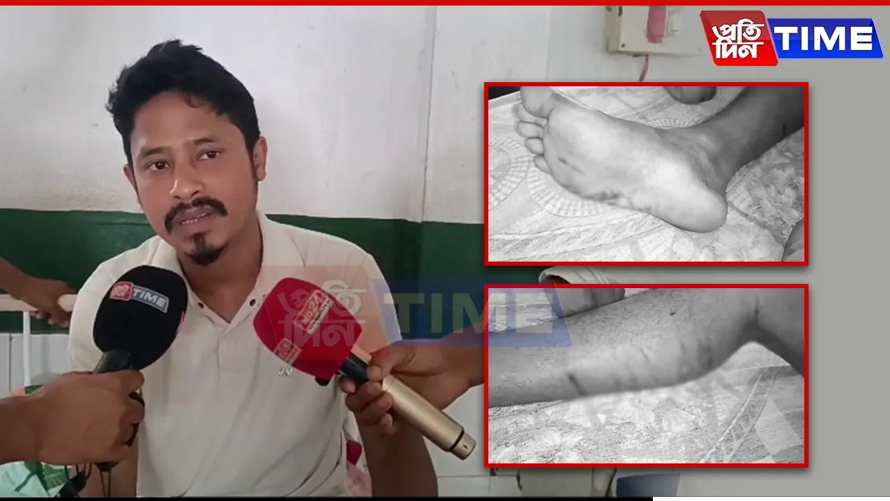 Bordumsa Police Torture: Custody or Cruelty? Assam Youth’s Ordeal Sparks Fury
