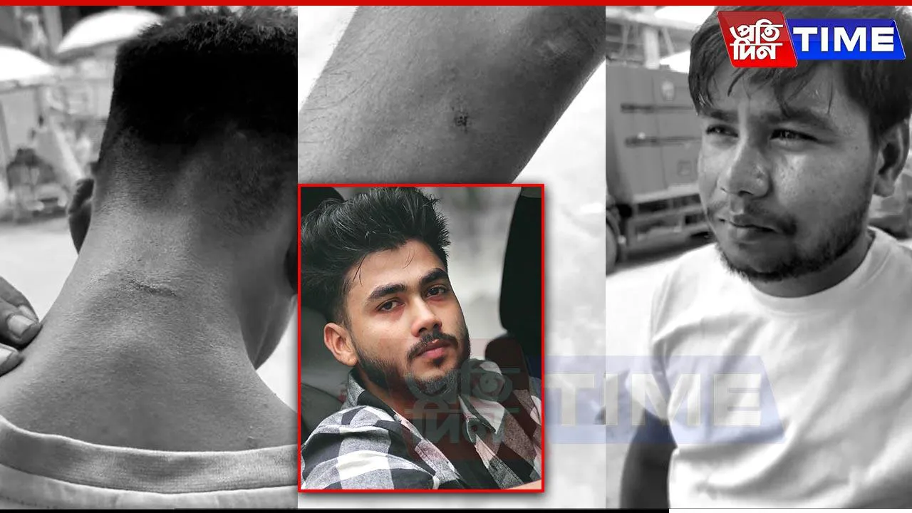 YouTuber Accused of Knife Attack on Two Vendors in Guwahati