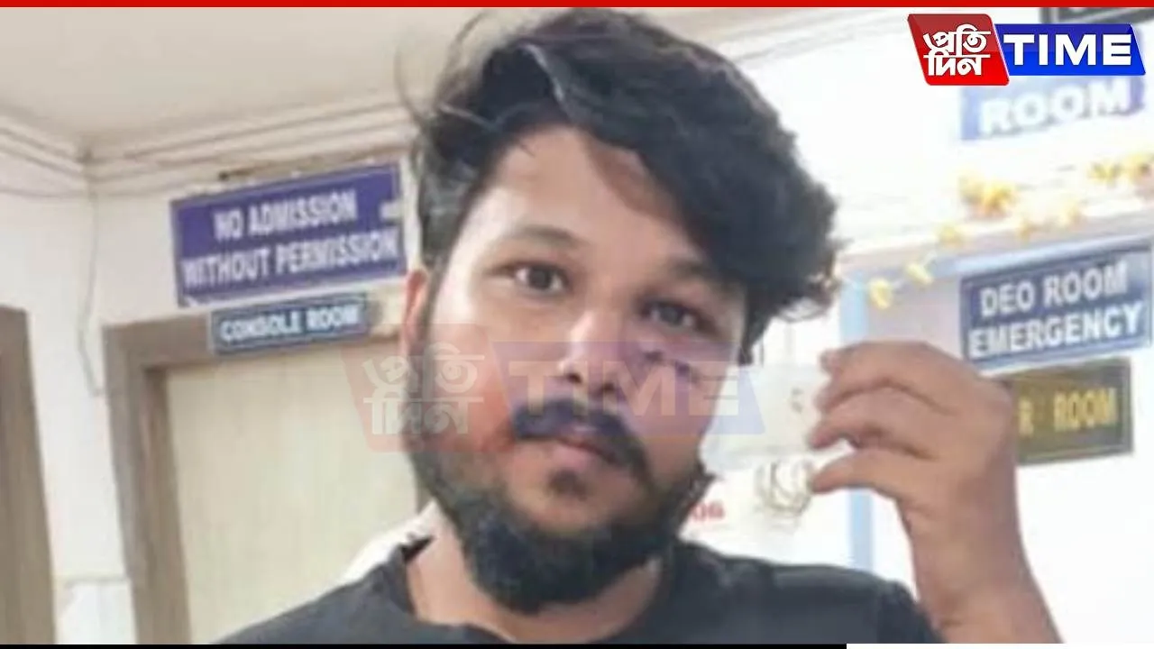 Assam: Jail Inmate Assaults Dipankar Barman, Victim Taken for Medical Examination
