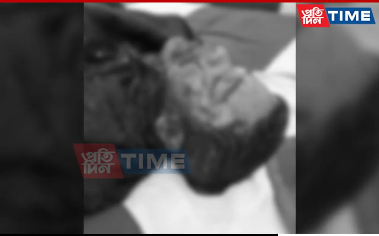 Guwahati: Basistha Youth Shot By Man From West Bengal