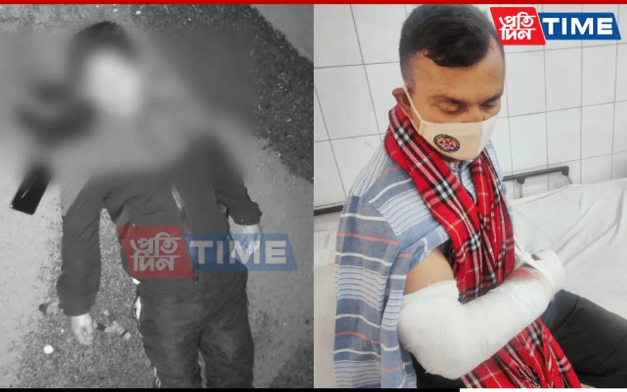Assam: Cop Shot As 2 Gunfights Go Down In Same Night In Chirang