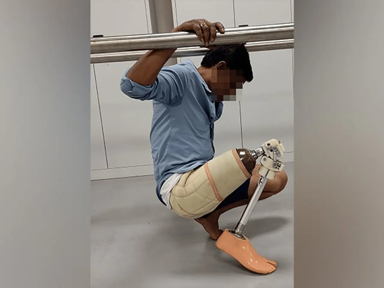 IIT Guwahati Develops Prosthetic Leg Suited For Indian Conditions