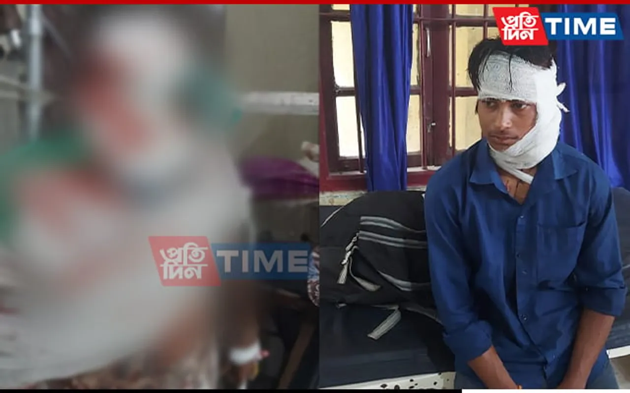Assam: Father-Son Duo Seriously Injured after Miscreant Attack 