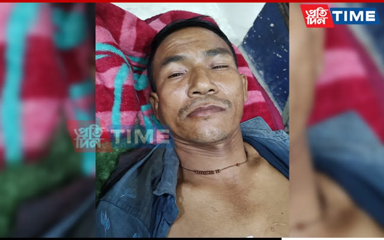 Assam: Civilian Mistaken for Poacher Shot in Baksa