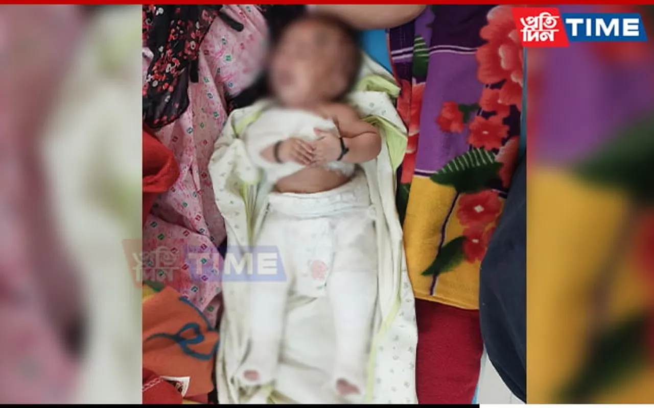 Guwahati: 5-Month-Old Baby Suffers Broken Arm, Legs at Hands Of Father