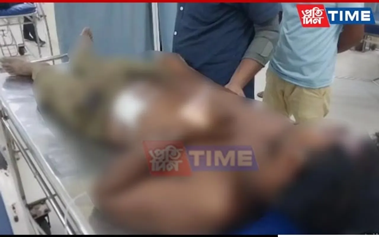 Man Sustains Severe Bullet Injuries in Firing Incident in Assam’s Hojai
