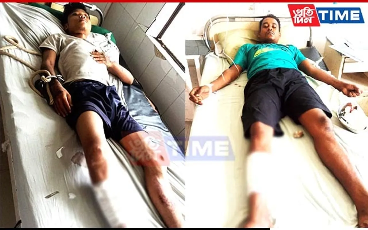 Guwahati: Two Mobile Thieves Shot By Cops While Attempting To Flee