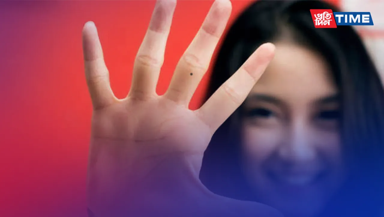 What does a Mole on your Palm signify?
