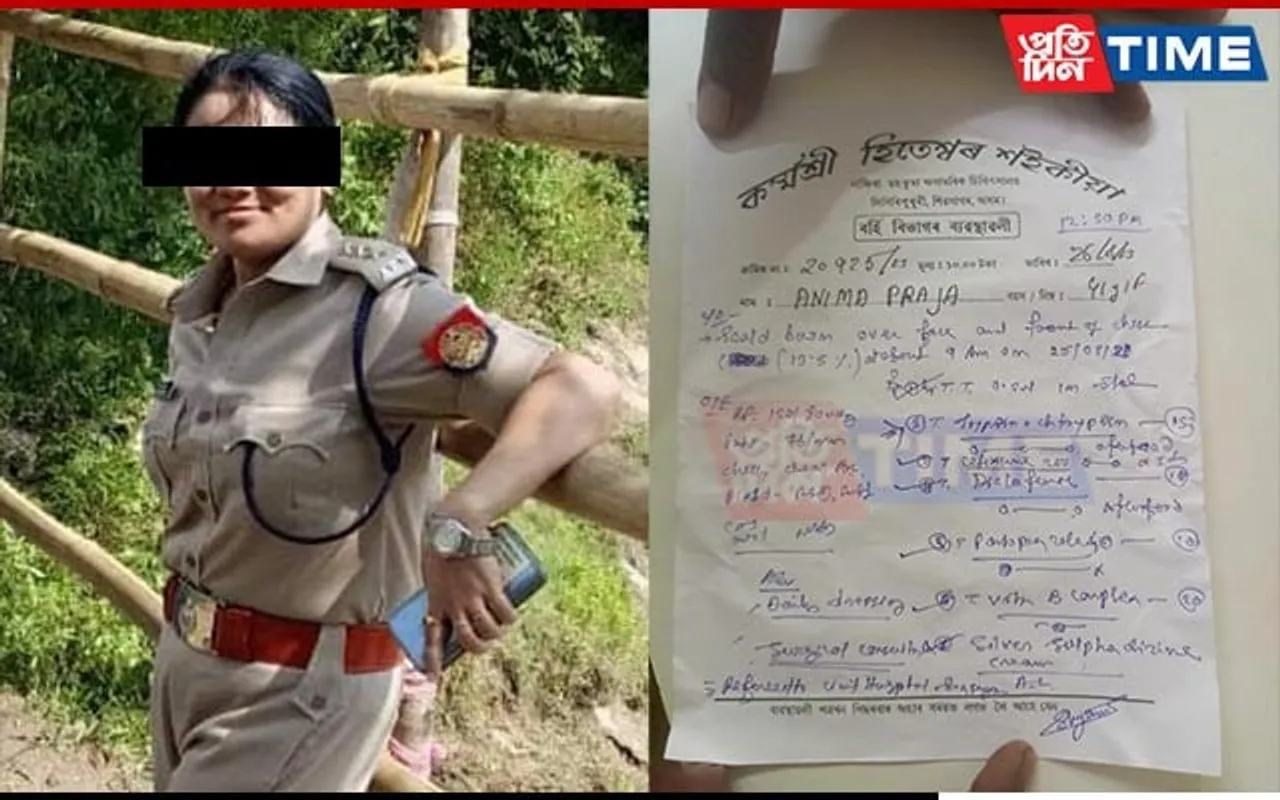 Assam Woman Police Officer Tortures Maid With Hot Water In Nazira