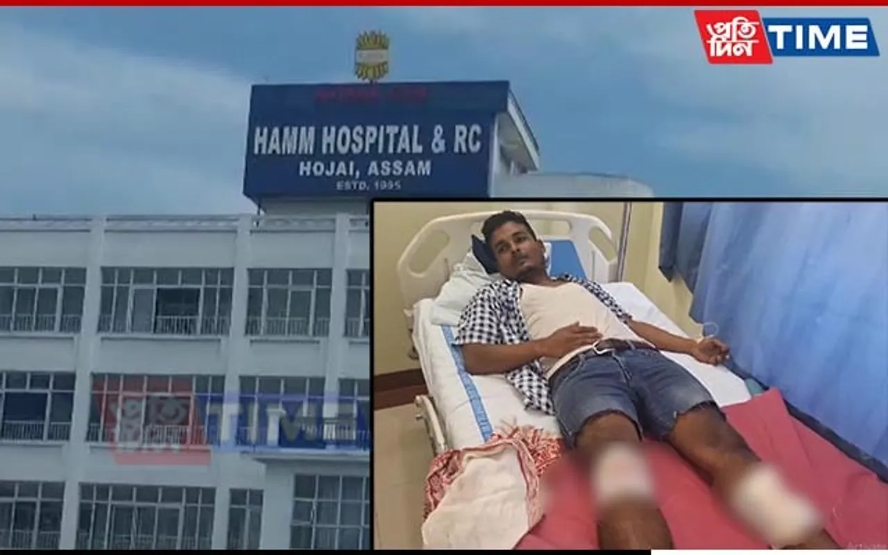 Assam: Dacoit Sustain Bullet Injuries in Police Firing in Hojai