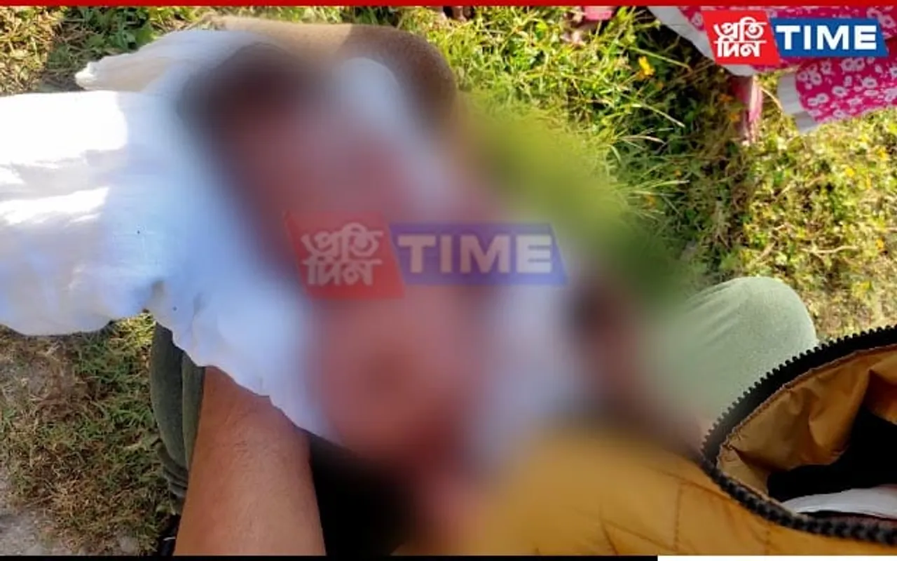 Abandoned New Born Baby Rescued in Jorhat