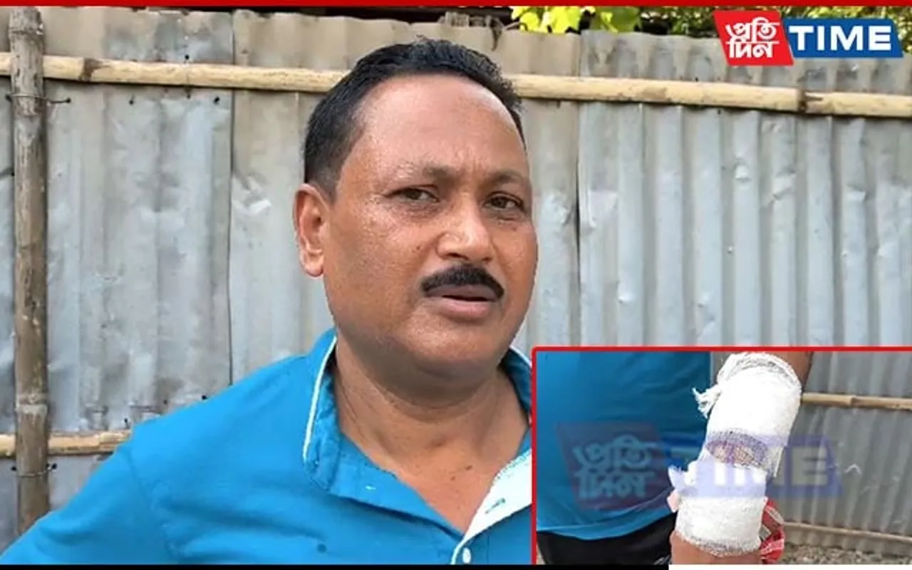 Guwahati: Miscreants Attack Cop With Blade In Attempt To Snatch Bag of Cash