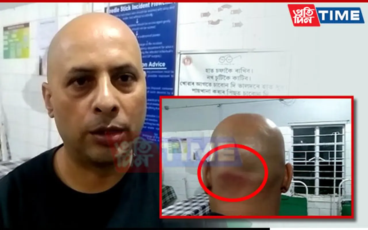 Assam: Gang of Miscreants Attack Hotel Owner & Staff with Machete Over Petty Reasons