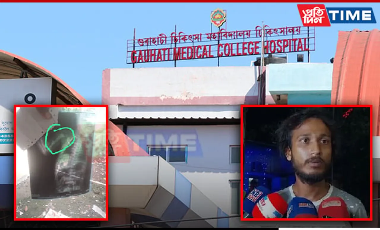 Medical Negligence at GMCH: Father Alleges Newborn’s Arm Broken During Delivery