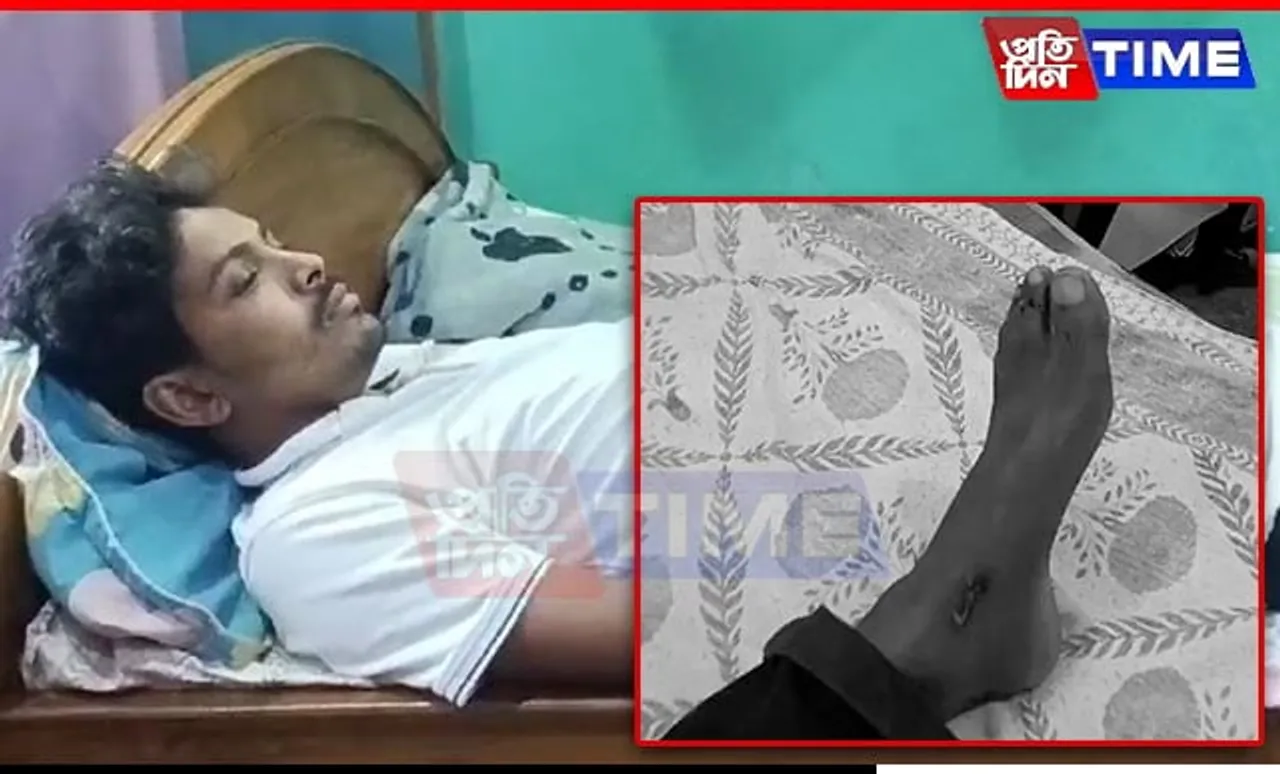 Assam: School Teacher Injured in Attack by Gang of Miscreants