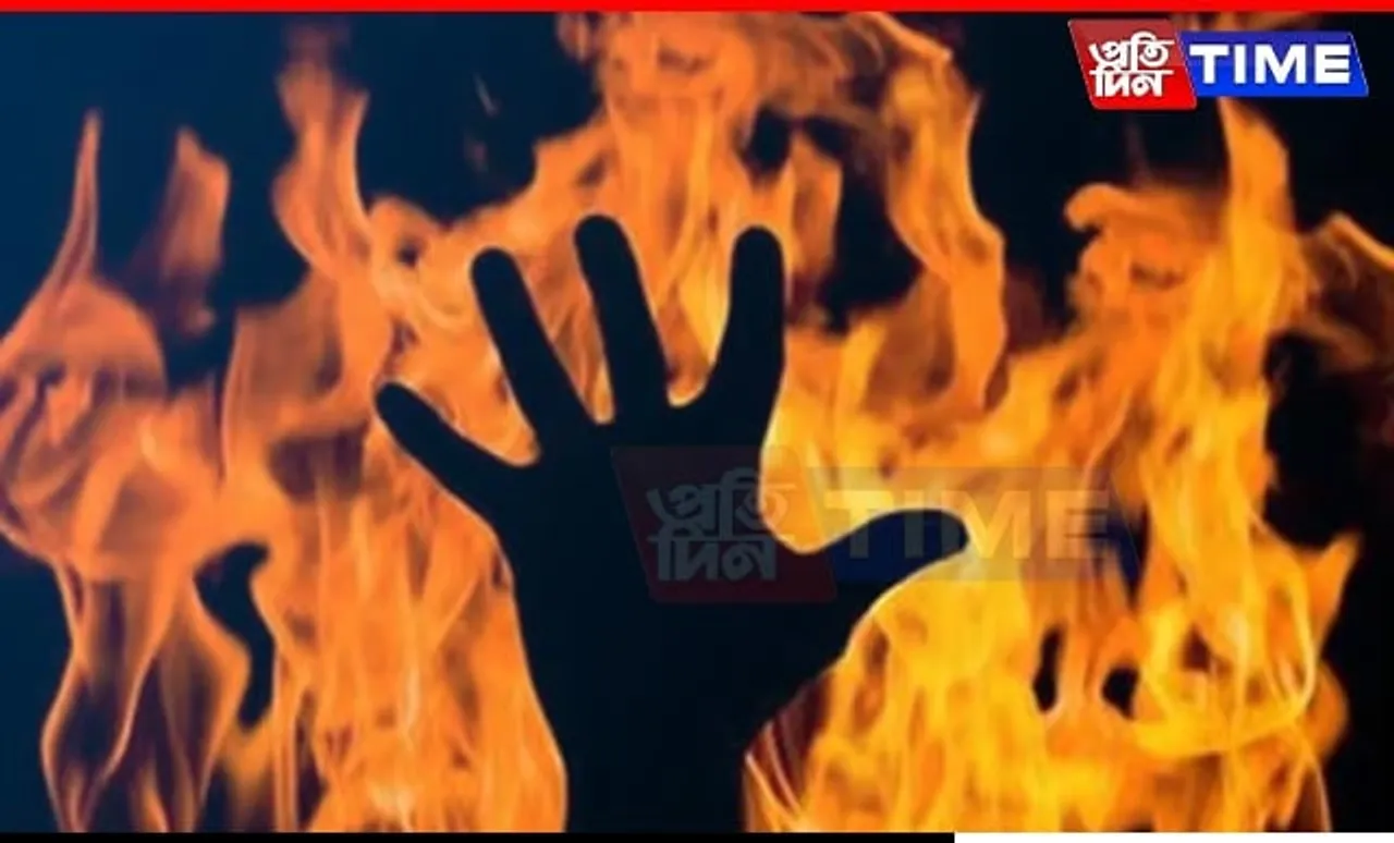 Assam: Firecracker Mishap Leaves 3 Children with Serious Burns in Morigaon