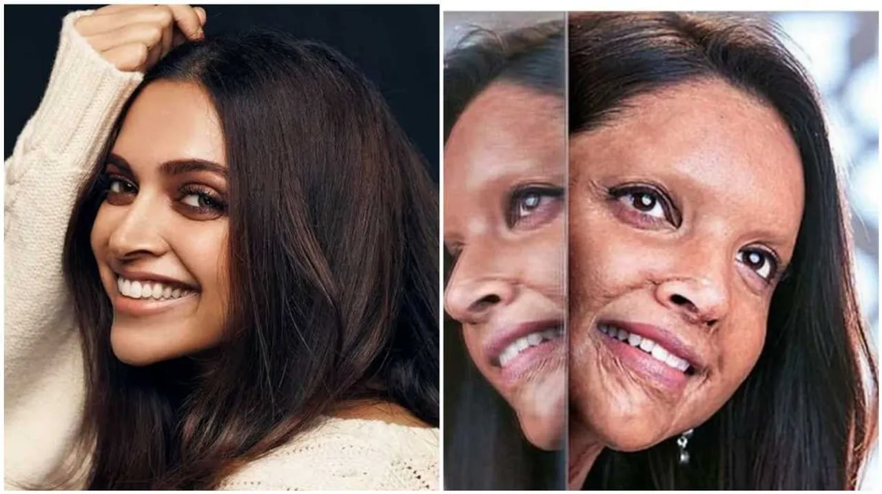Deepika’s ‘Chhapaak’ look creates sensation