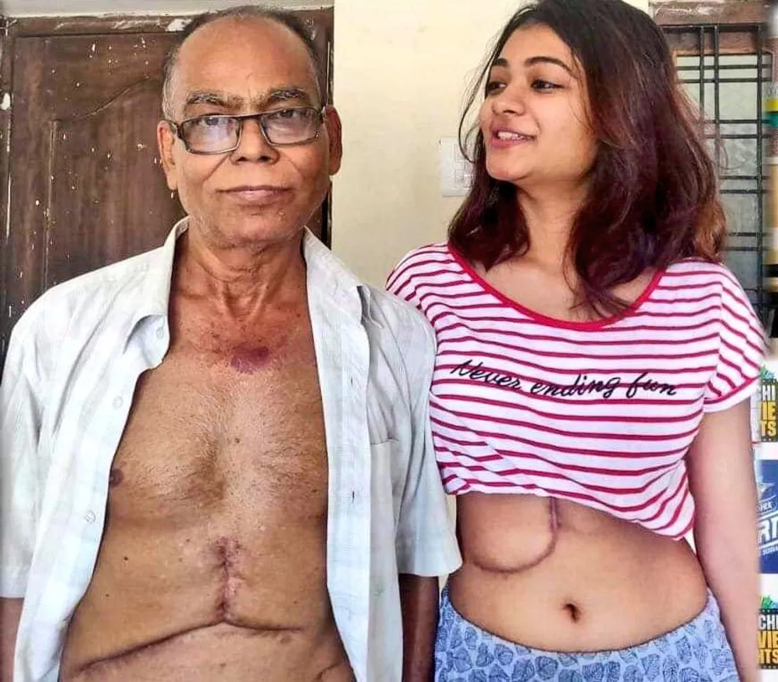 19 year old daughter gives 65% liver to save father