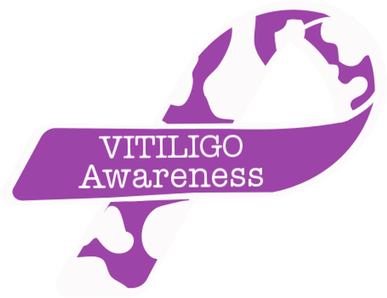 Vitiligo-Walk in City
