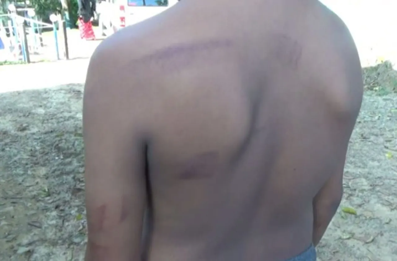 Karimganj JNV student ragged by seniors
