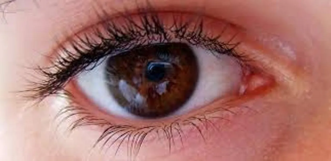 Vehicle Pollutants Heightened Risk for Common Eye Condition