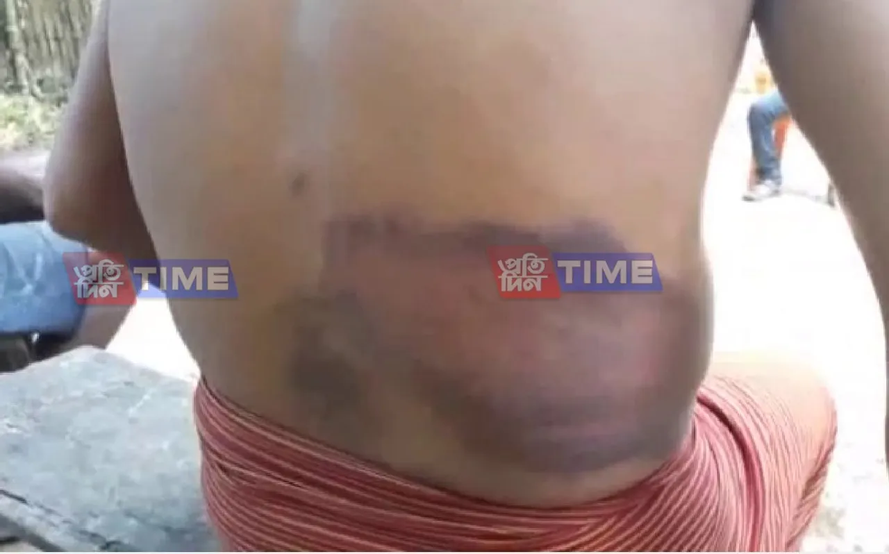 Man Attacked by Locals in Mariani